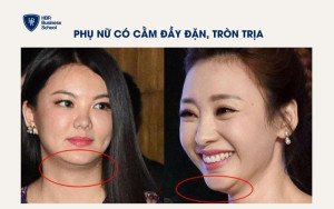 Cằm đầy đặn, tròn trịa