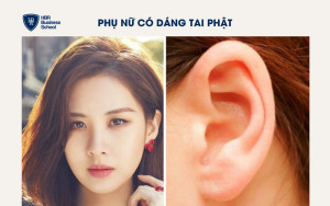 Dáng tai Phật (tai to, dái tai dày)