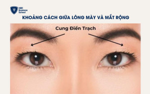 Khoảng cách giữa lông mày và mắt rộng